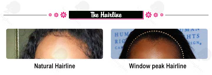 hair line